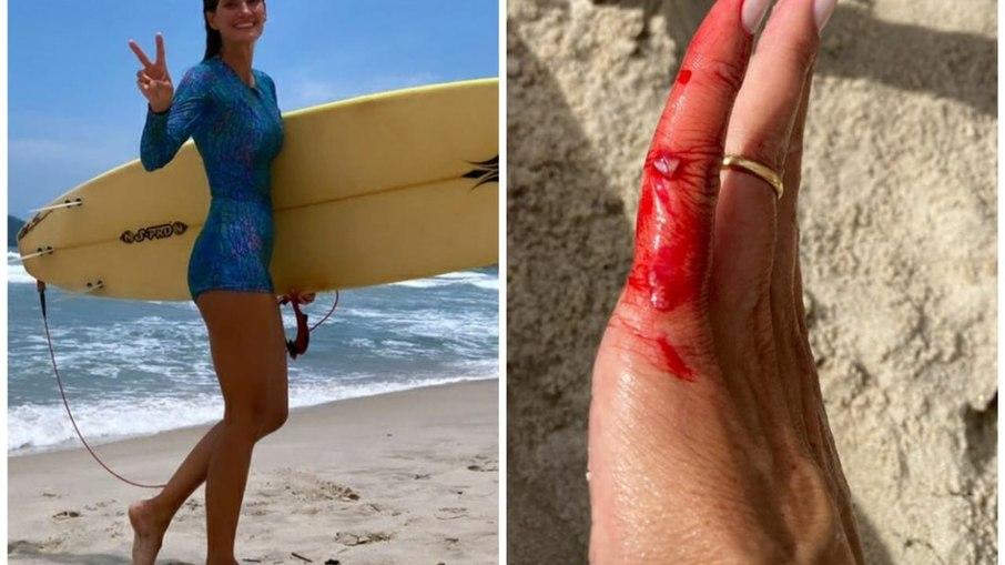 Isabella Fiorentino se machuca após dia de surfe