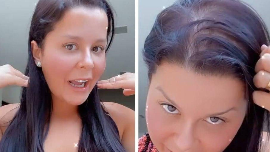 Maraisa diz que sofre de alopecia e mostra: 