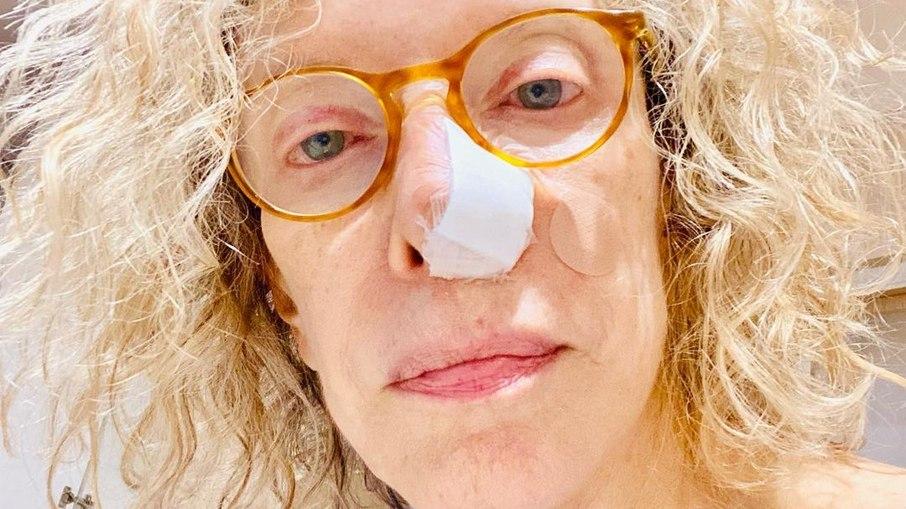 Marília Gabriela é submetida a uma cirurgia após descobrir câncer de pele