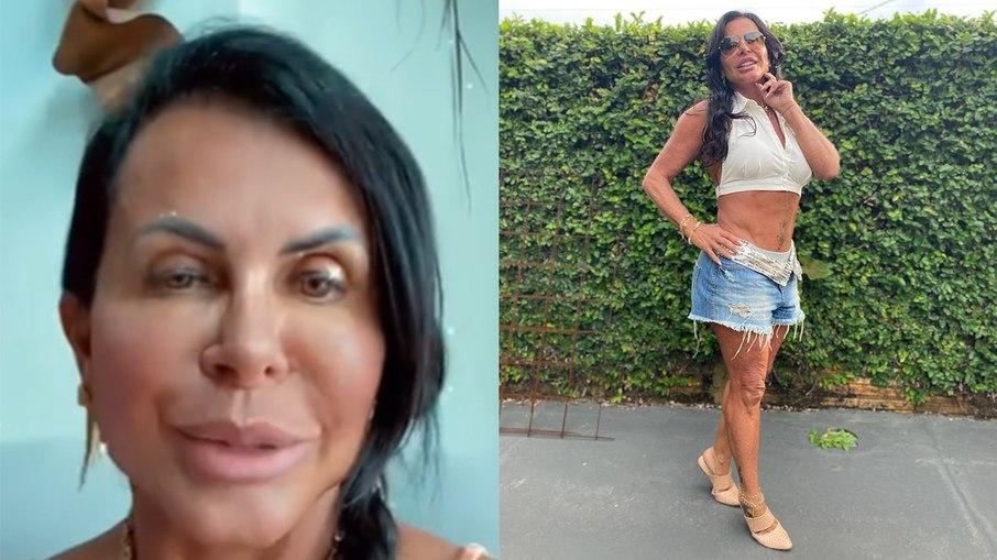Gretchen nega plástica na barriga: 