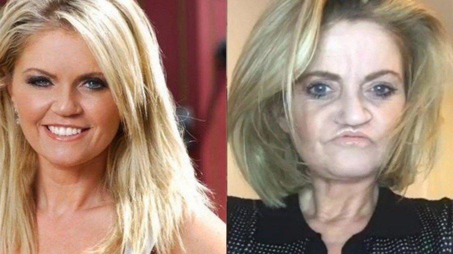 Atriz faz cirurgias após ter o rosto destruído pelo uso de drogas