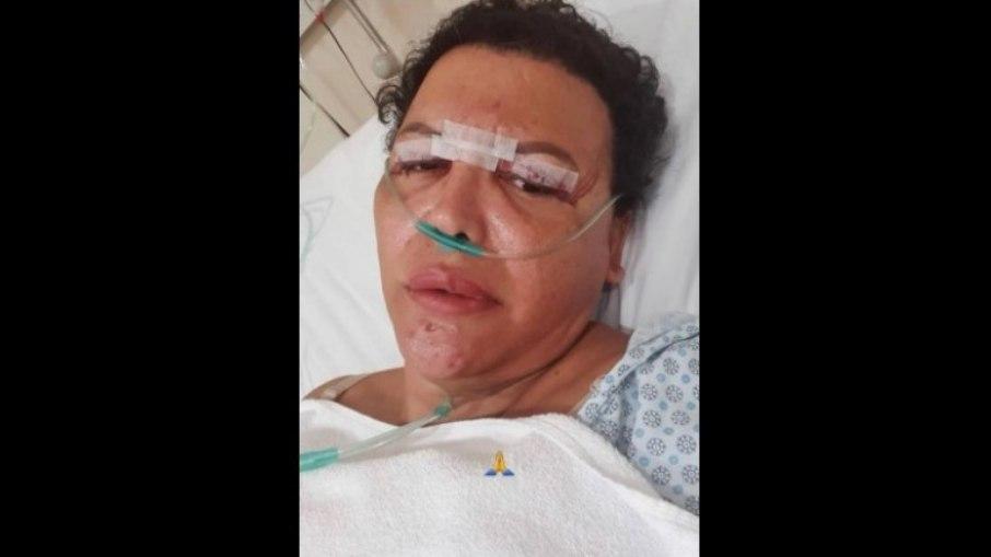 Cirurgia de R$ 20 mil realizada por Luisa Marilac  foi um sucesso