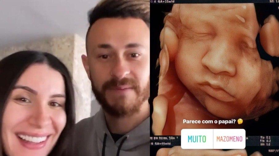 Fred mostra o rosto do filho com Bianca Andrade em ultrassom 4D