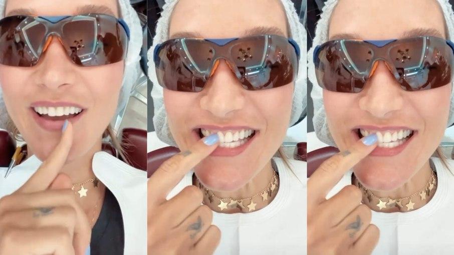 Gabriela Pugliesi troca lente de contato dos dentes por modelo mais natural