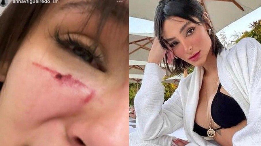 Modelo denuncia ex-namorado por agressão e recebe apoio de Neymar