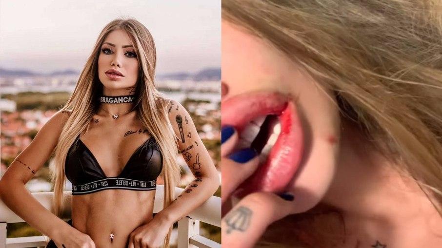 Funkeira diz que foi vítima de agressões físicas: 