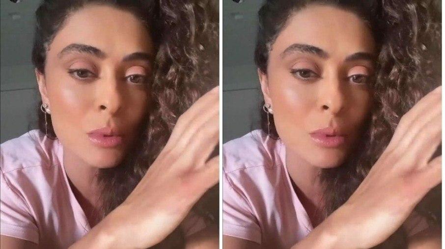 Juliana Paes sofre queimadura química: 