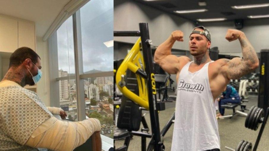 Leo Stronda posta foto no hospital após ter corpo queimado em acidente