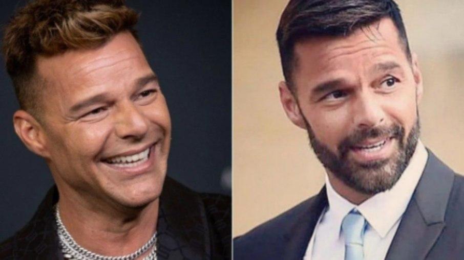 Ricky Martin surge com rosto diferente e nega procedimento estético