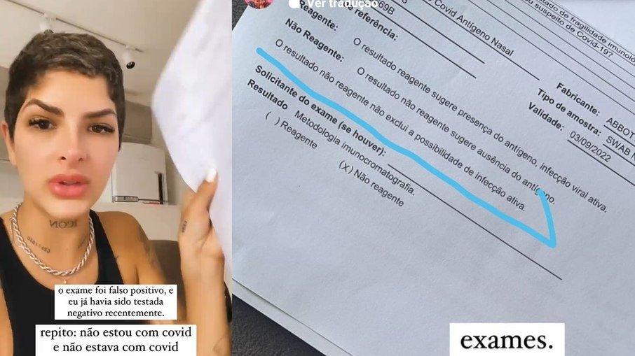 Novos exames de Lary Bottino não descartam infecção por Covid; veja