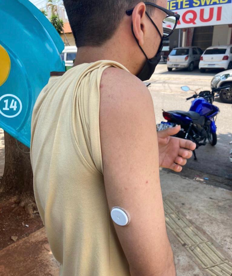 Projeto-piloto de monitoramento glicêmico avança em Goiânia