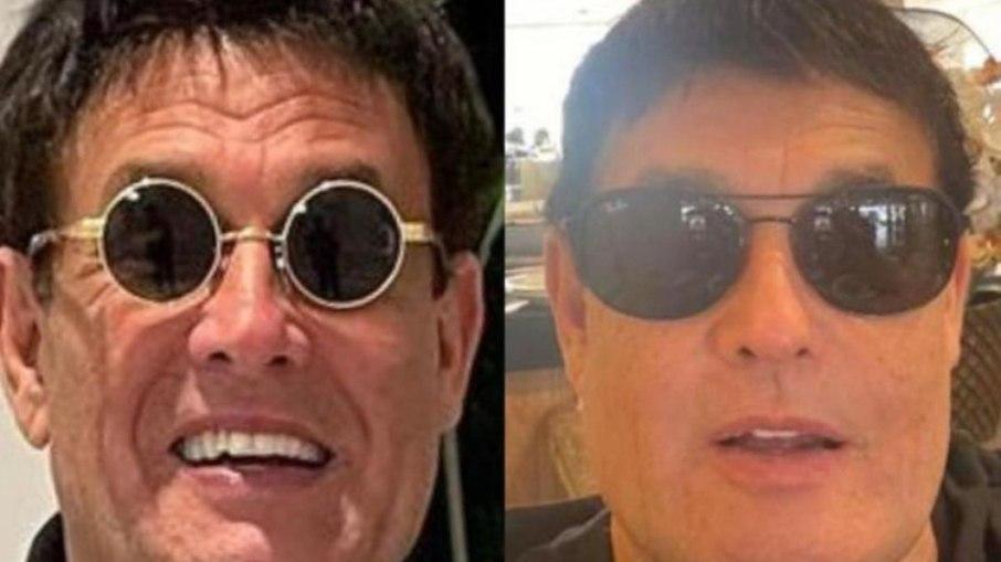 Sérgio Mallandro realiza harmonização facial: 'Tô novinho'