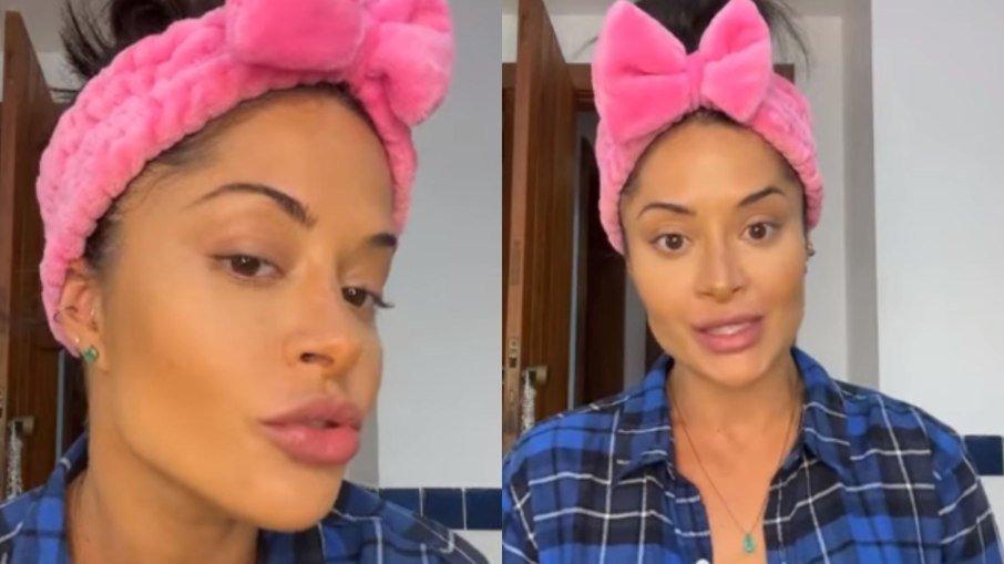 Aline Campos admite que exagerou nos procedimentos estéticos