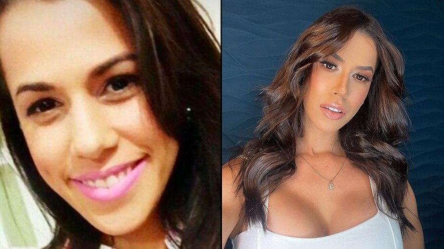 Casa de vidro: Veja os procedimentos estéticos feitos por Larissa