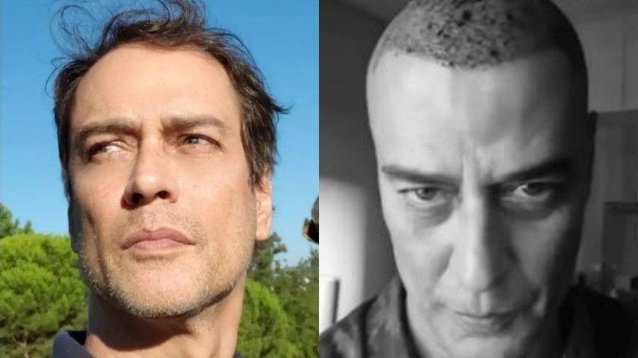 Marcello Antony realiza transplante capilar aos 57 anos