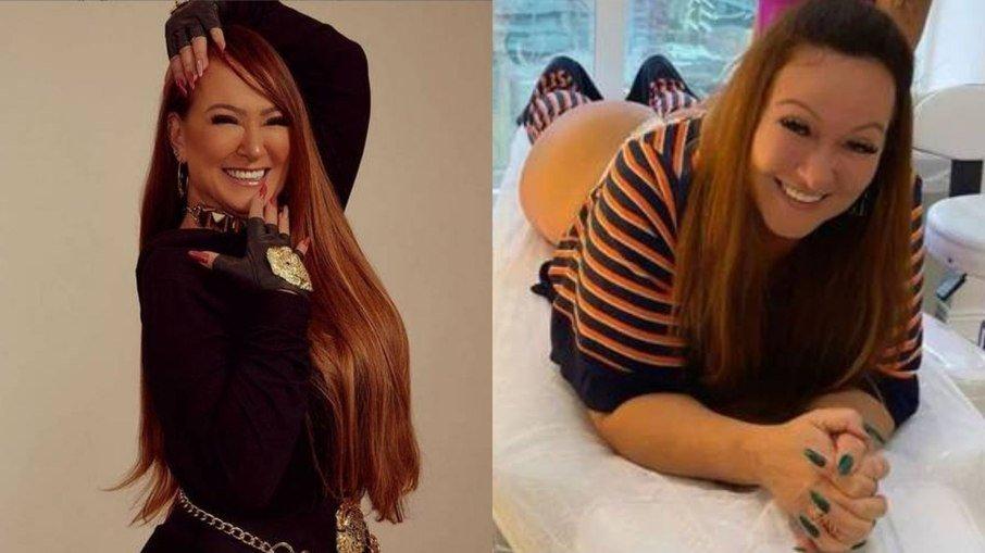 Nadine Gonçalves, mãe de Neymar, faz tratamento estético no bumbum