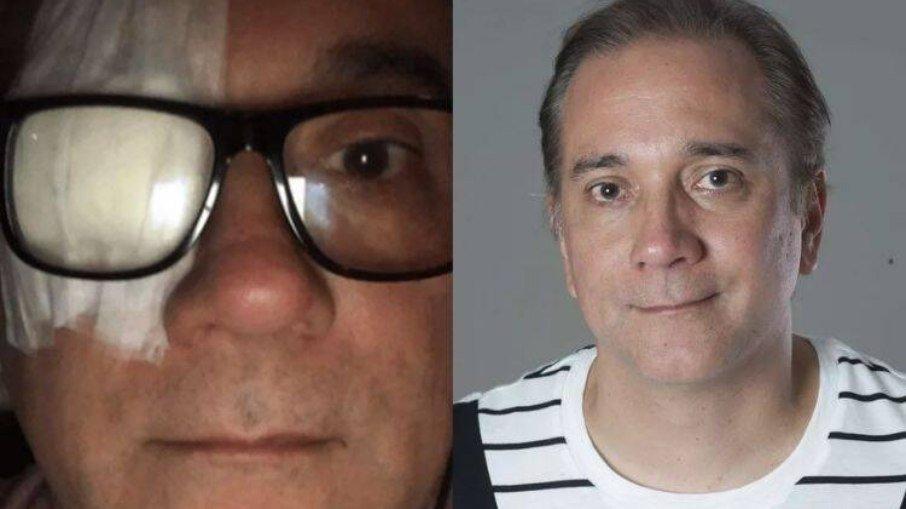 Bruno Gouveia celebra volta à banda Biquíni Cavadão após retirar tumor