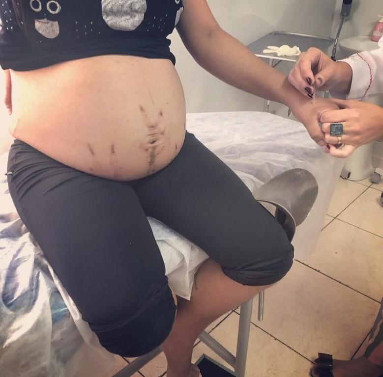 Secretaria de Saúde realiza 1° Simpósio de Práticas Integrativas e Complementares em Saúde