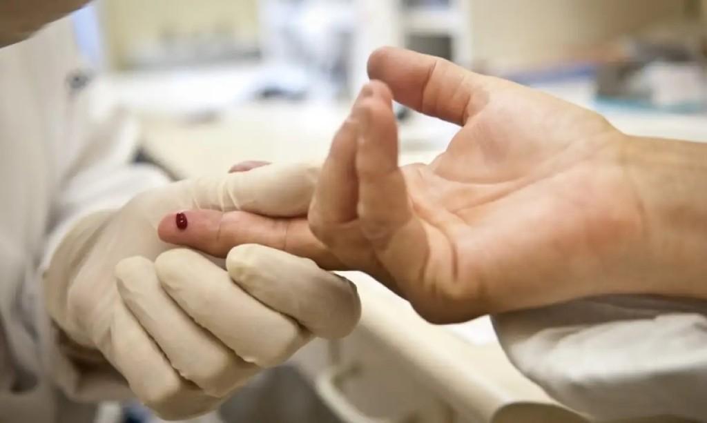 Prefeitura de Goiânia disponibiliza rede de apoio e alerta para prevenção ao HIV